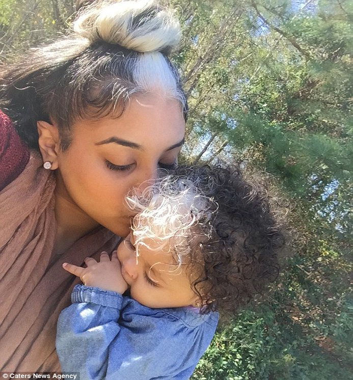 South Carolina Baby’s Matching White Birthmark Is Going Viral