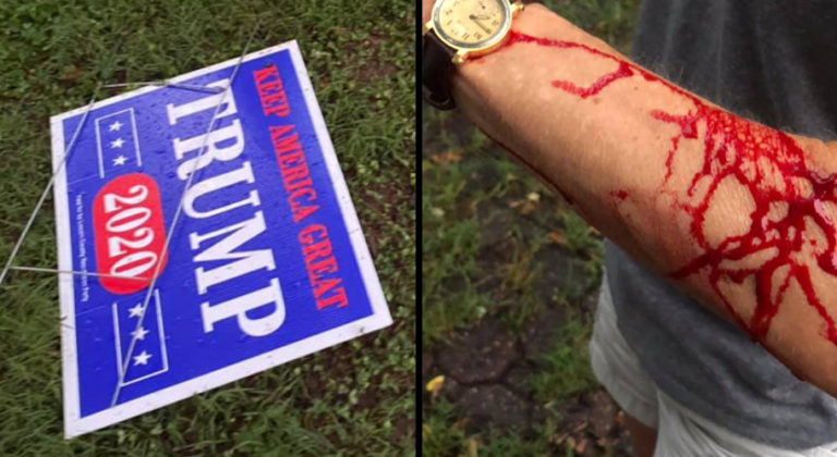 Lincolnton Man Shoots Woman For Mistakenly Taking His Trump Sign