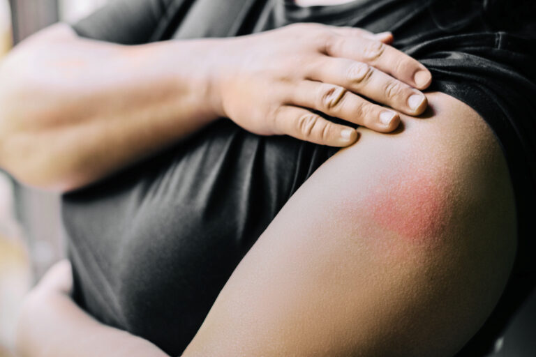 North Carolina Prepares for Measles Amid New Surge of US Cases