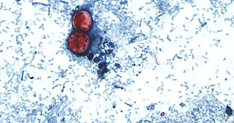 Health Officials Warn of ‘Explosive Diarrhea’ Parasite Spreading Across North Carolina